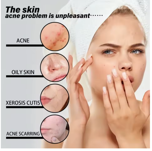 Aceite Facial Esencial 100% Natural con Vitamina E – Hidratante, Antiarrugas y Reafirmante